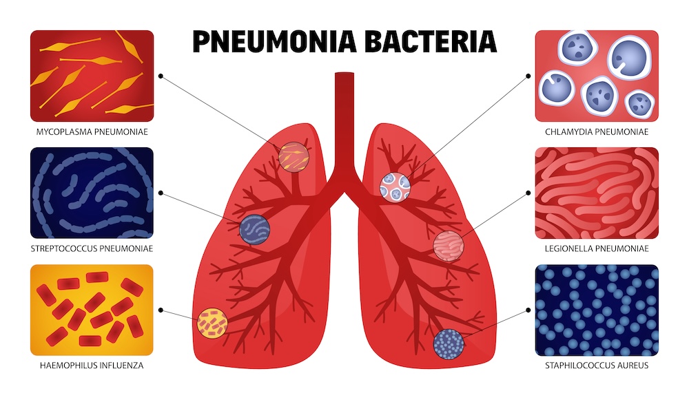 pneumonia