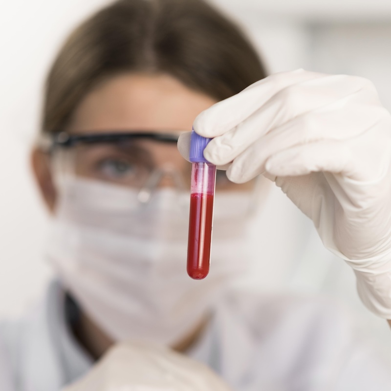 laboratorní testy